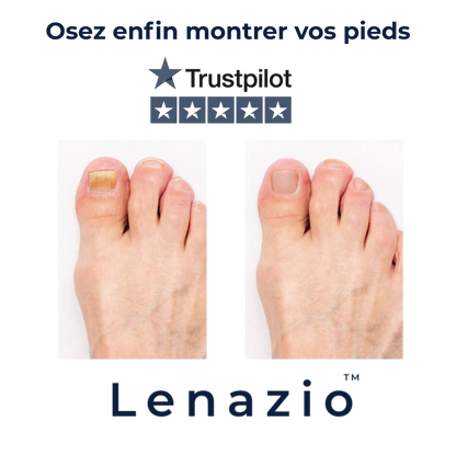 Stylo Ongles Lenazio™ | Soin purifiant & réparateur
